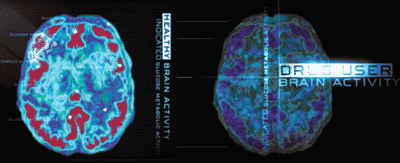 cervello sano, cervello drogato