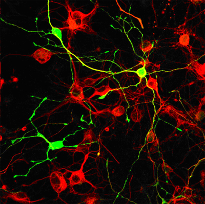 neuroni dell'ippocampo