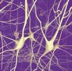 Stati vegetativi, italiano nuovo metodo prognosi con EEG.