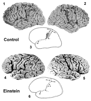 Il cervello di Einstein Il cervello di Einstein